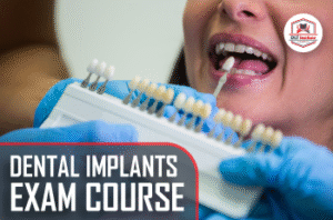 Dental Implants Exam Course